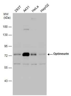 Western Blot: Optineurin Antibody [NBP3-13114]