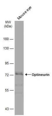 Western Blot: Optineurin Antibody [NBP3-13114]