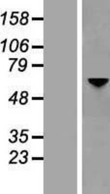 Western Blot: Optineurin Overexpression Lysate [NBL1-13949]