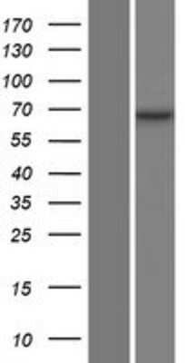 Western Blot: Optineurin Overexpression Lysate [NBP2-11265]