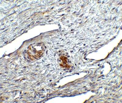Immunohistochemistry: Orai1 Antibody - BSA Free [NBP1-76762]
