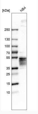 Western Blot: Orai1 Antibody [NBP1-85463]