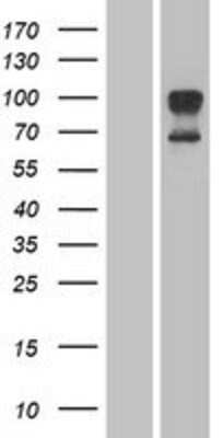 Western Blot: Orai1 Overexpression Lysate [NBP2-04406]