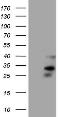 Western Blot: Orai2 Antibody (OTI8D11) [NBP2-46295]