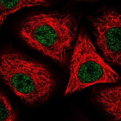 Immunocytochemistry/ Immunofluorescence: Orai2 Antibody [NBP2-55443]