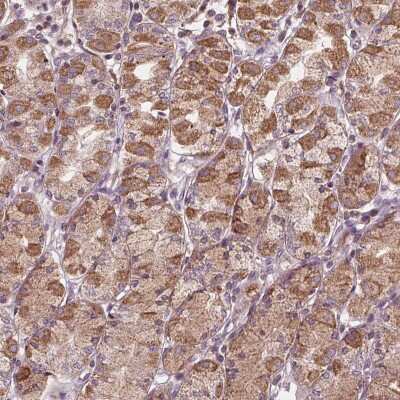 Immunohistochemistry: Orai2 Antibody [NBP2-39064]