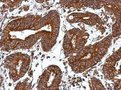 Immunohistochemistry-Paraffin: Orai2 Antibody [NBP2-19630]