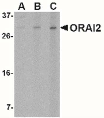 Western Blot: Orai2 AntibodyBSA Free [NBP1-77283]