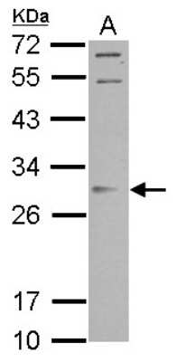 Western Blot: Orai2 Antibody [NBP2-19630]