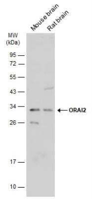 Western Blot: Orai2 Antibody [NBP2-19630]