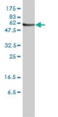 Western Blot: Orc2 Antibody (3E11-1G5) [H00004999-M01]