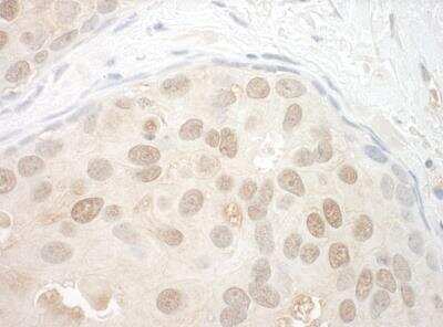 Immunohistochemistry: Orc2 Antibody [NBP1-46176]