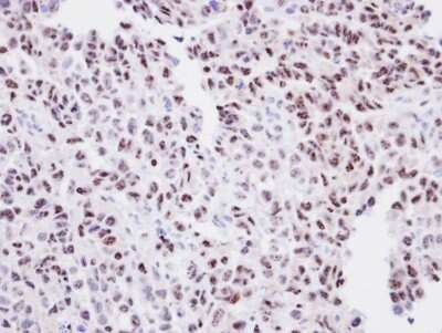 Immunohistochemistry-Paraffin: Orc2 Antibody [NBP1-33189]