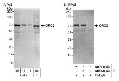 Immunoprecipitation: Orc2 Antibody [NBP1-46175]