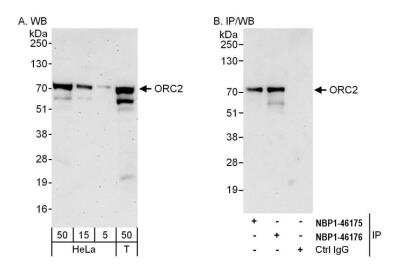 Western Blot: Orc2 Antibody [NBP1-46176]