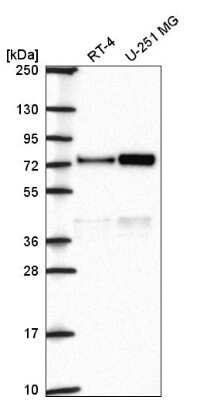 Western Blot: Orc2 Antibody [NBP2-56503]