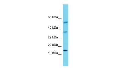 Western Blot: Orexin A/Hypocretin-1 Antibody [NBP3-09385]