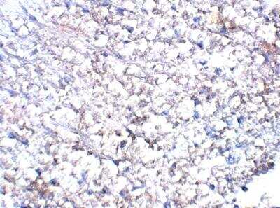 Immunohistochemistry-Paraffin: Orexin Antibody [NBP3-12327]