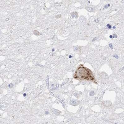 Immunohistochemistry-Paraffin: Orexin B/Hypocretin-2 Antibody [NBP3-17408]