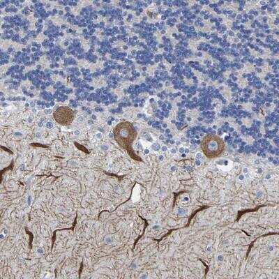 Immunohistochemistry-Paraffin: Orexin R1/HCRTR1 Antibody [NBP1-82463]