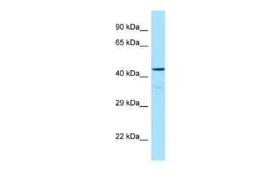 Western Blot: Orexin R1/HCRTR1 Antibody [NBP2-87990]