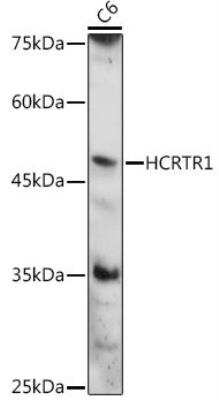 Western Blot: Orexin R1/HCRTR1 AntibodyAzide and BSA Free [NBP2-95106]