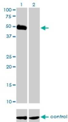Western Blot: Orexin R2/HCRTR2 Antibody (1E3) [H00003062-M01]