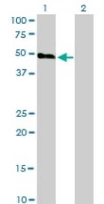 Western Blot: Orexin R2/HCRTR2 Antibody (1E3) [H00003062-M01]