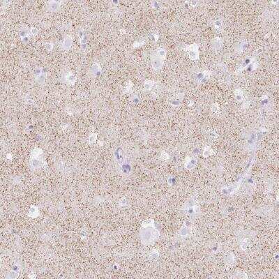 Immunohistochemistry-Paraffin: Orexin R2/HCRTR2 Antibody [NBP2-33718]