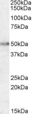 Western Blot: Orexin R2/HCRTR2 Antibody [NB100-74579]