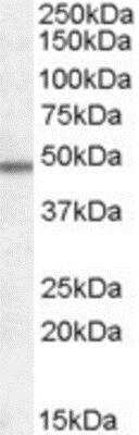 Western Blot: Orexin Receptor 1/2 Antibody [NB100-93465]