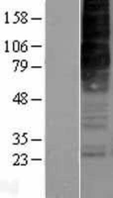 Western Blot: Orexin R2/HCRTR2 Overexpression Lysate [NBP2-04198]