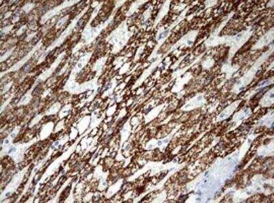 Immunohistochemistry-Paraffin: Ornithine Carbamoyltransferase Antibody (OTI8A1) [NBP2-46303]