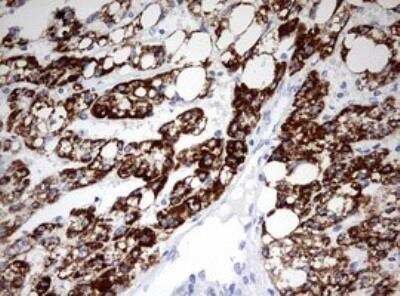 Immunohistochemistry-Paraffin: Ornithine Carbamoyltransferase Antibody (OTI8A1) [NBP2-46303]