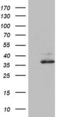 Western Blot: Ornithine Carbamoyltransferase Antibody (OTI8A1) [NBP2-46303]