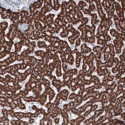 Immunohistochemistry-Paraffin: Ornithine Carbamoyltransferase Antibody (CL4045) [NBP2-59038]