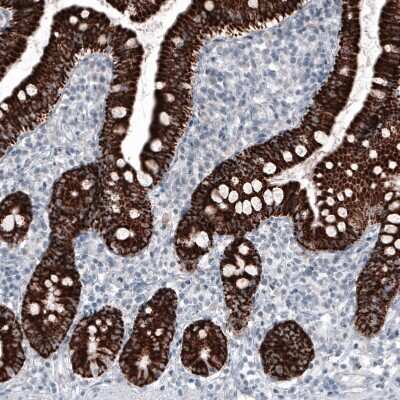 Immunohistochemistry-Paraffin: Ornithine Carbamoyltransferase Antibody (CL4045) [NBP2-59038]