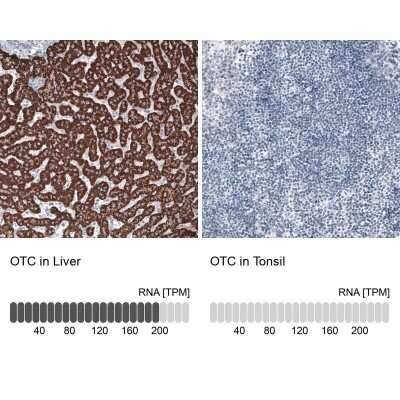 Immunohistochemistry-Paraffin: Ornithine Carbamoyltransferase Antibody (CL4045) [NBP2-59038]