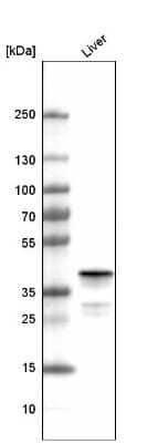 Western Blot: Ornithine Carbamoyltransferase Antibody (CL4045) [NBP2-59038]