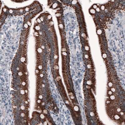 Immunohistochemistry-Paraffin: Ornithine Carbamoyltransferase Antibody (CL4046) [NBP2-59039]