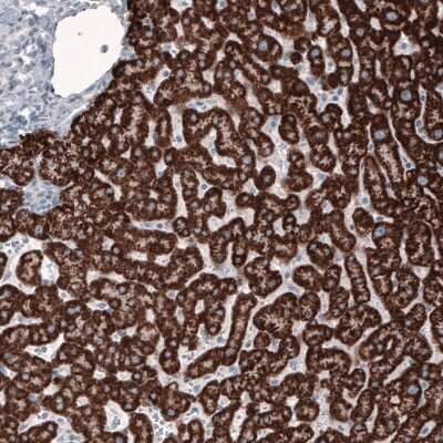 Immunohistochemistry-Paraffin: Ornithine Carbamoyltransferase Antibody (CL4046) [NBP2-59039]