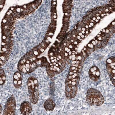 Immunohistochemistry-Paraffin: Ornithine Carbamoyltransferase Antibody (CL4046) [NBP2-59039]
