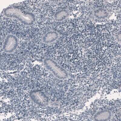 Immunohistochemistry-Paraffin: Ornithine Carbamoyltransferase Antibody (CL4046) [NBP2-59039]