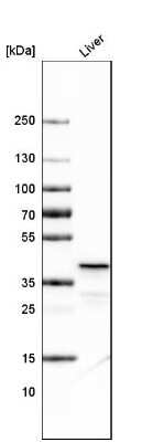 Western Blot: Ornithine Carbamoyltransferase Antibody (CL4046) [NBP2-59039]