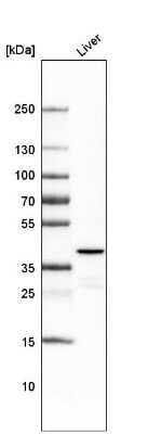 Western Blot: Ornithine Carbamoyltransferase Antibody (CL4049) [NBP2-59040]