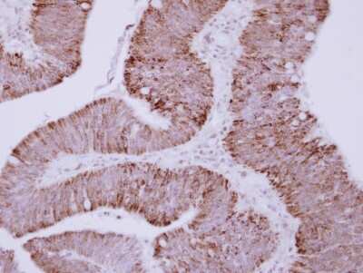 Immunohistochemistry-Paraffin: Ornithine Carbamoyltransferase Antibody [NBP1-31582]