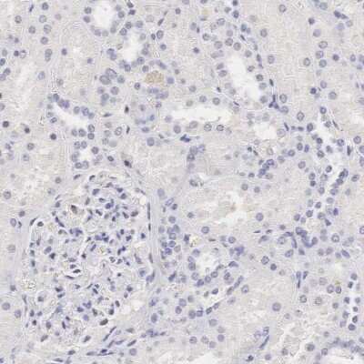 Immunohistochemistry-Paraffin: Ornithine Carbamoyltransferase Antibody [NBP1-87408]