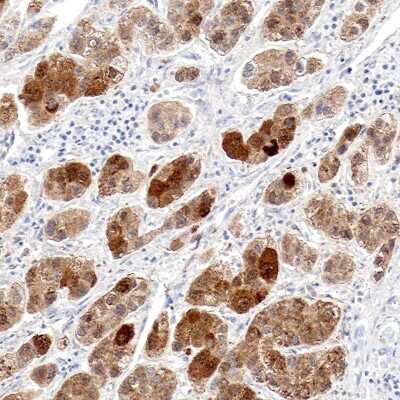 Immunohistochemistry-Paraffin: Ornithine Carbamoyltransferase Antibody [NBP1-87408]