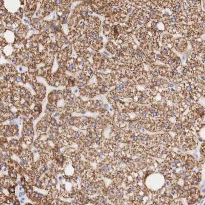 Immunohistochemistry-Paraffin: Ornithine Carbamoyltransferase Antibody [NBP1-87408]