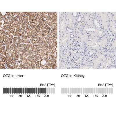 Immunohistochemistry-Paraffin: Ornithine Carbamoyltransferase Antibody [NBP1-87408]